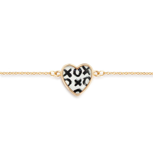 X & O Bracelet